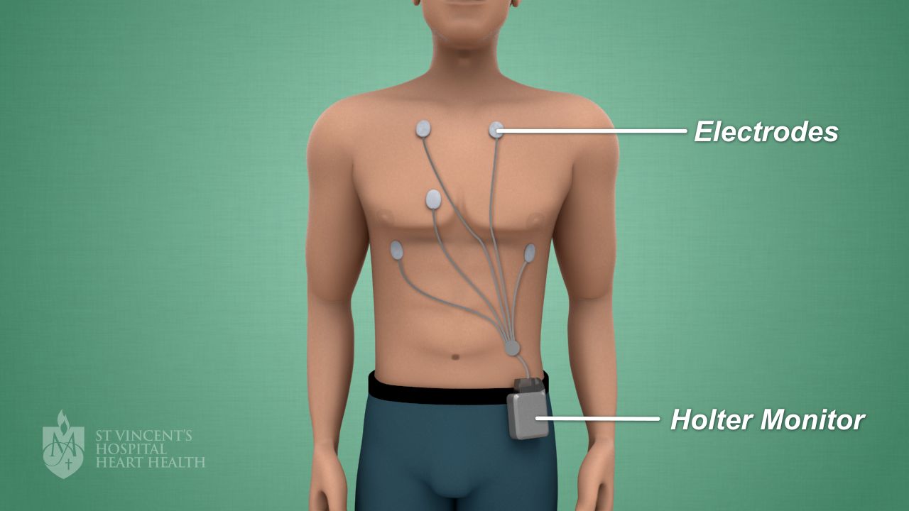 10_HolterMonitor.jpg