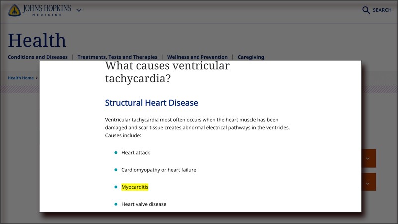 myocarditis23.jpg