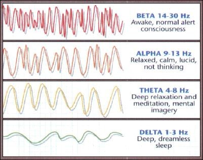 brainwaves1.jpg