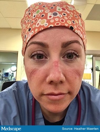 ht_200427_heather_maerten_saving_skin_380x500.jpg