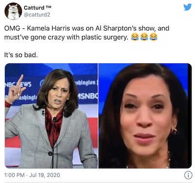 kamala-plastic-surgery.jpg