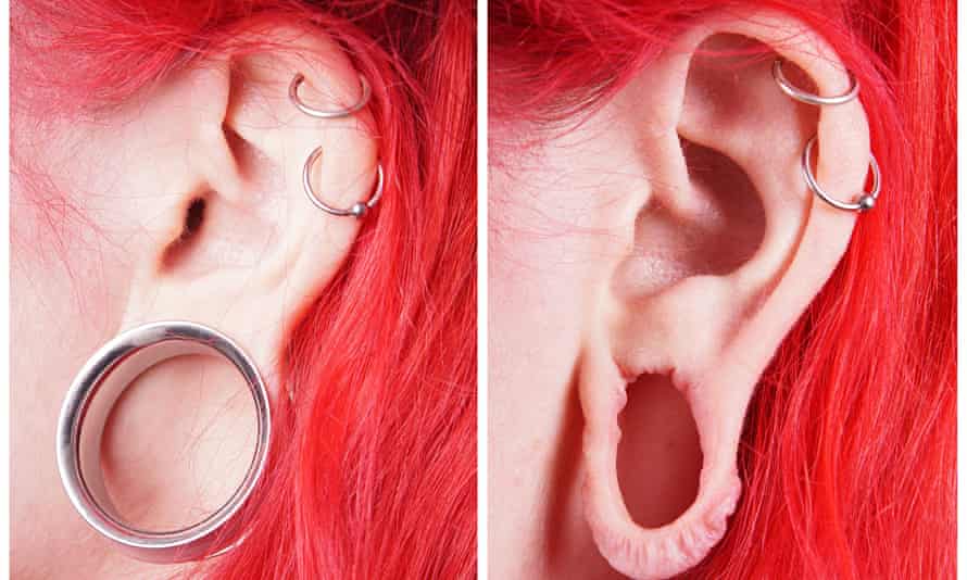 stretched-ear-lobe-pierci-014.jpg